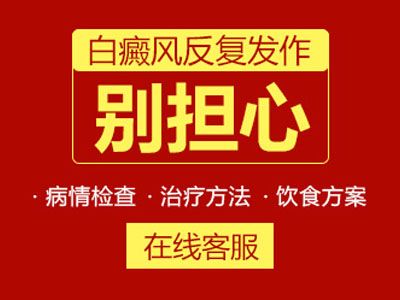 台州脸上白癜风怎么治疗好?